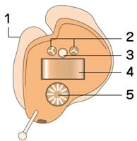 耳穴式補聴器イメージ