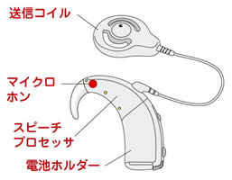 人工内耳体外部イメージ