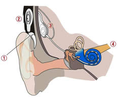 人工内耳のしくみ　イメージ